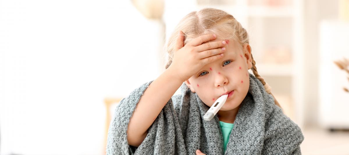 banner of Chickenpox is a Common Ailment For Children